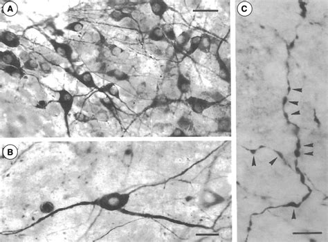 Histaminergic Hdc Positive Neurons In An Organotypic Culture A From