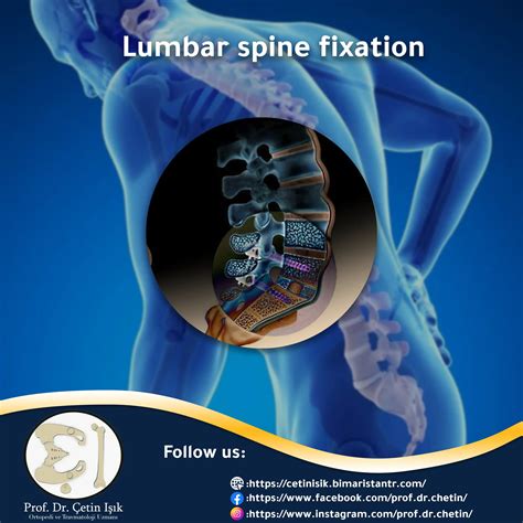 Neck and spine surgery - Dr. What's wrong with you?