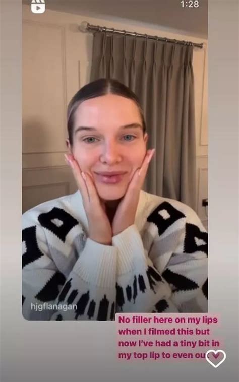 Helen Flanagan Shows Off Her New Lips And Super Blonde Hair After