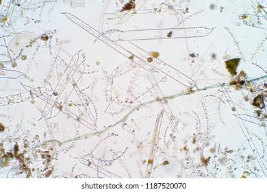 Marine Aquatic Plankton Under Microscope View Stock Photo (Edit Now) 1187520070