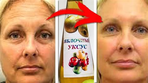 Нанесла яблочный уксус на лицо... Такого эффекта Я не ожидала ...