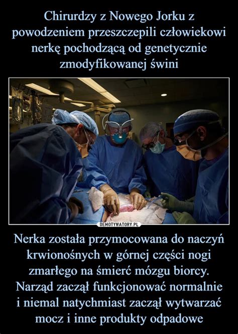 Chirurdzy Z Nowego Jorku Z Powodzeniem Przeszczepili Cz Owiekowi Nerk