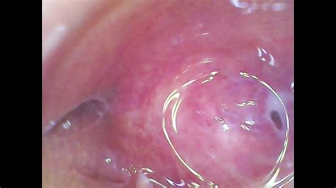 Real Pussy Orgasm Contraction Cam Inside The Pussy Sperm Found In Pussy Juice Under Microscope