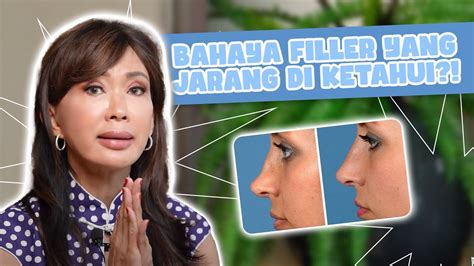 Mancung Instant Dengan Filler Stop Berlebihan Filler Bikin Hidung Jadi