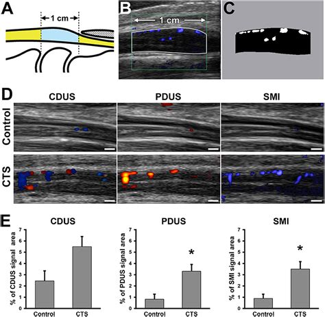 Frontiers Diagnostic Utility Of Superb Microvascular Imaging And