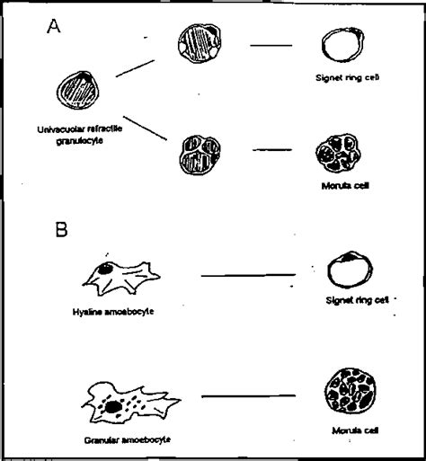 Differentiation Pathways Of Signet Ring Cell And Morula Cell A