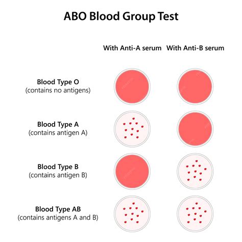 Premium Vector | ABO Blood Group Test