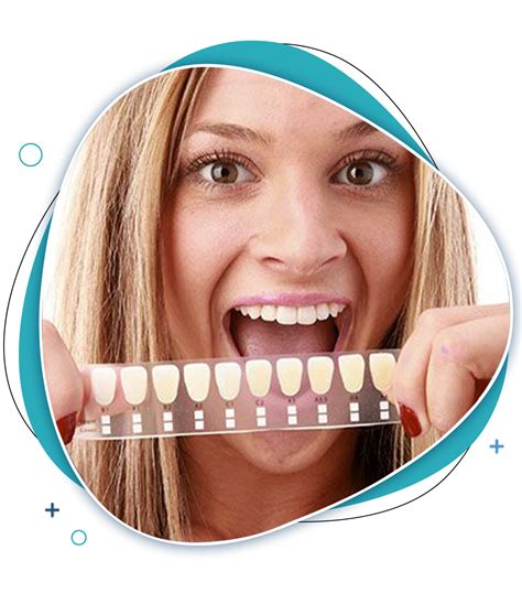 Dental Veneers In Glen Waverley Ek Dental Surgery