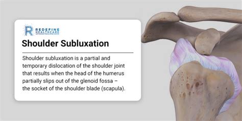 Shoulder Subluxation - NJ's Top Orthopedic Spine & Pain Management Center