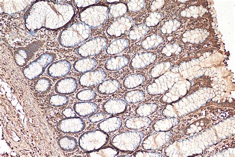 ENO1 antibody 11204 1 AP Proteintech 武汉三鹰生物技术有限公司