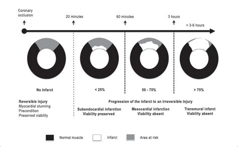 Myocardial Viability On Cardiac Magnetic Resonance ABC Cardiol