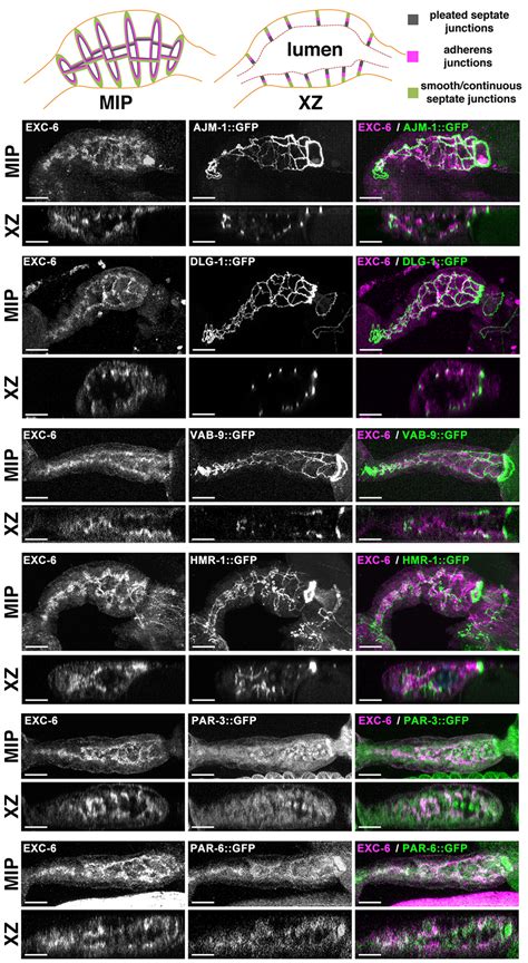 Functional Importance Of An Inverted Formin C Terminal Tail At