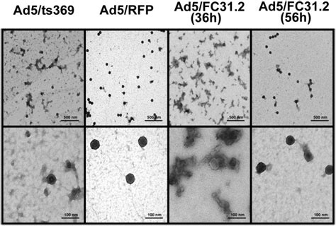 Uranyl acetate staining was used to visualize viral particles ...