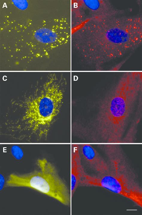 N-terminal domain of PEX13 can partially restore PTS1 import defect in ...