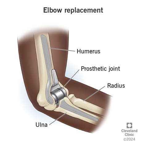 Elbow Joint Cartilage