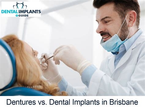 Dentures Vs Dental Implants In Brisbane