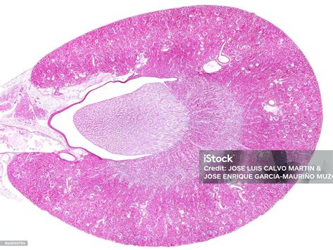 istock