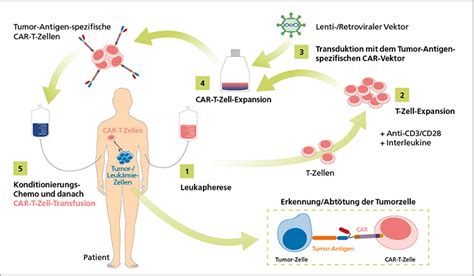 Therapie von Lymphom und Leukämie Patienten mittels CAR T Zellen Seite 2