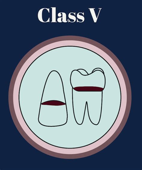 Tooth Numbering System Diagram Svg Png Jpeg Ai Pdf Dental Dentistry Jaw
