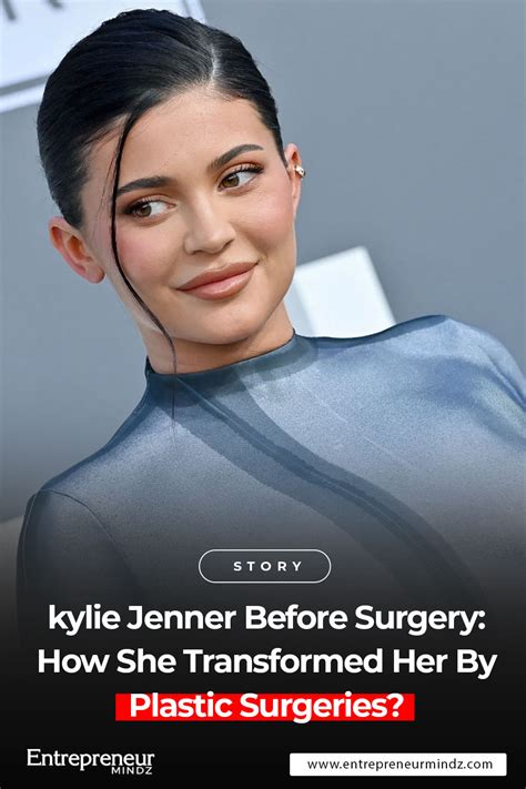 kylie Jenner Before Surgery: How She Transformed Her By Plastic Surgeries?