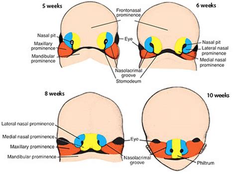 What Causes Cleft Lips And Palates Earwell Center Of Excellence