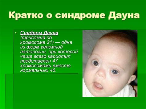 Даун синдромы презентация - 86 фото