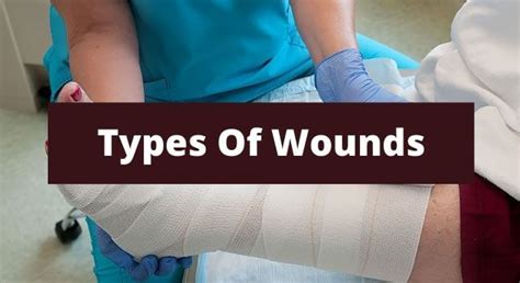 Different Types Of Wounds - Wound Care Surgeons