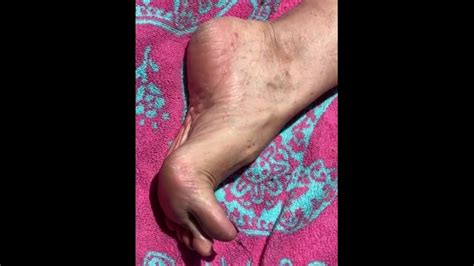 Fan Request Granny Naked In Sun Shows Dirty Rough Soles Toes GILF