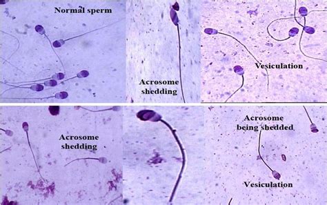 Different Stages Of Cattle Bull Spermatozoa During The Process Of Download Scientific Diagram