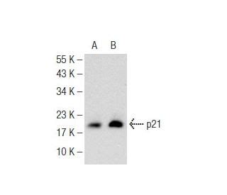 Sodium phenylbutyrate | CAS 1716-12-7 | SCBT - Santa Cruz Biotechnology 