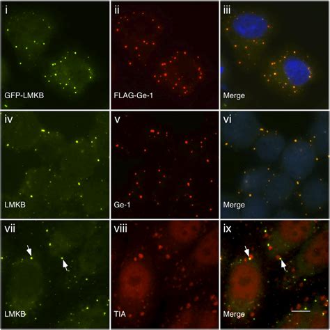 Indirect Immunofluorescence Shows That Lmkb Localizes To P Bodies