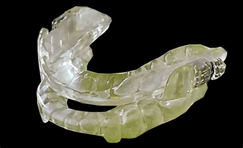 snoring treatment  effective solutions  mandibular device