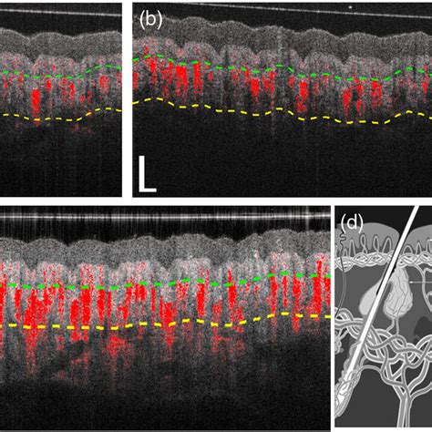 Typical Cross Sectional B Scans Of OCT Structure Gray Overlaid With