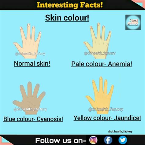 Anemia Skin Color