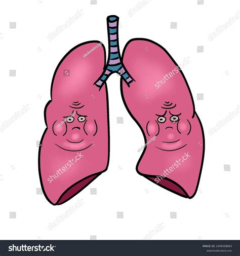 Lung Anatomy Illustration Pulmonary Edema Stock Illustration 2249108683