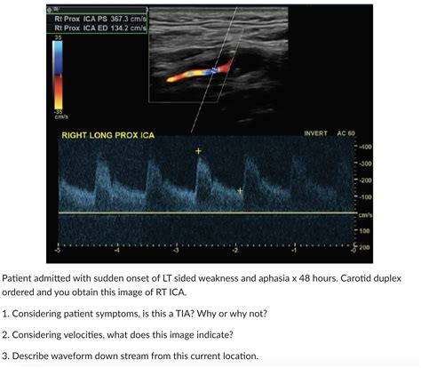 Solved Patient Admitted With Sudden Onset Of Lt Sided Chegg