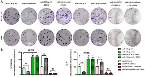 MiRNA 338 3p Inhibits The Migration Invasion And Proliferation Of