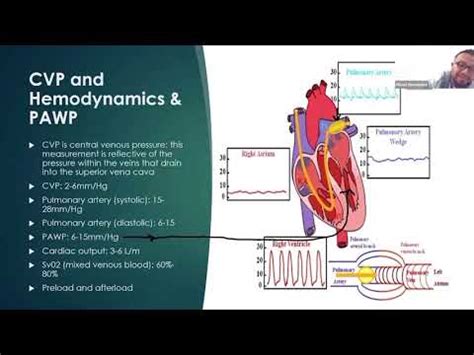 Learn NCLEX Now Hemodynamics CVP PAWP YouTube