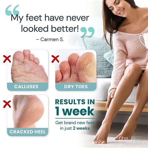 L'AMOUR Exfoliating Foot Peeling Masks - Removes Dead Skin & Calluses