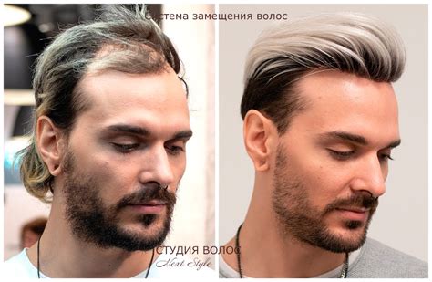 Мужские изделия из натуральных волос | Студия волос NEXT STYLE
