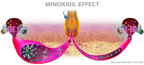 Reviving Your Crown: 5 Steps To Reversing Male Hair Loss