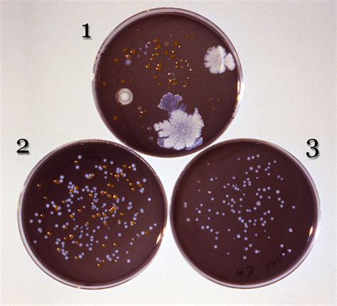 Public Domain Picture These Three Agar Plates Were Used To Isolate