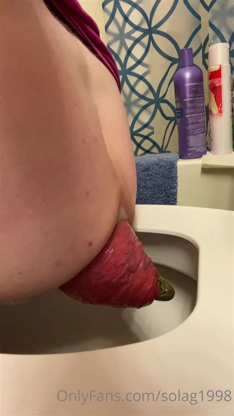 BBW Girl With Big Prolapse 16 ThisVid