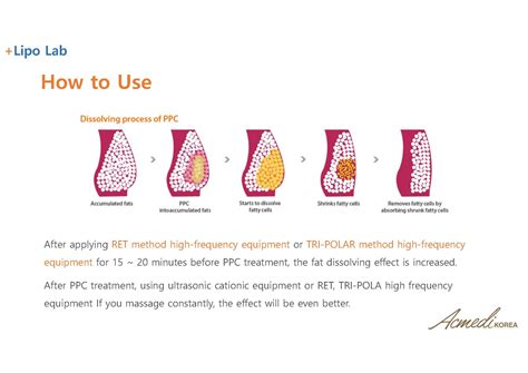 Lipo Lab for body slimming | tradekorea