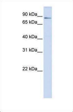 Anti-ZBTB16 antibody produced in rabbit affinity isolated antibody ...