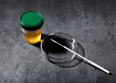 Симптомы, последствия и лечение уретрита в клинике