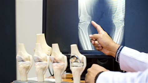 Choose the Right Orthopedic Surgeon for Your Second Opinion