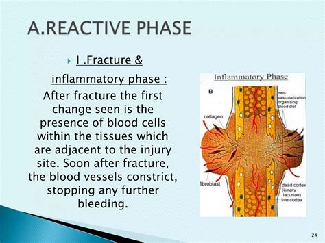 Fractures...types and healing of fractures | PPTX