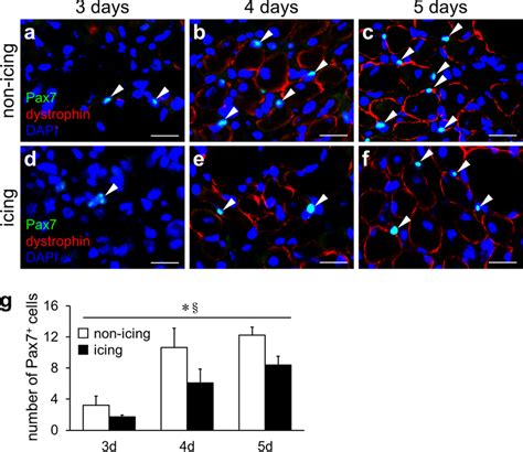 Pax7⁺ cell distribution in the regenerating area after skeletal muscle ...