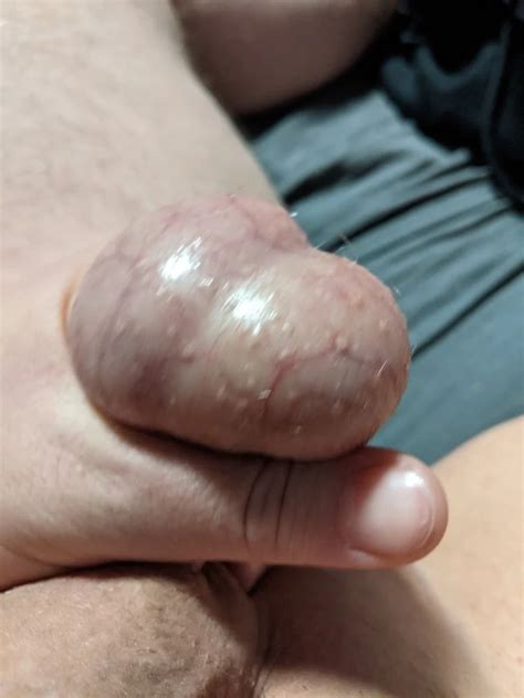 Ball Pictures 3 My Balls Hurting 20 Nude Pics XHamster